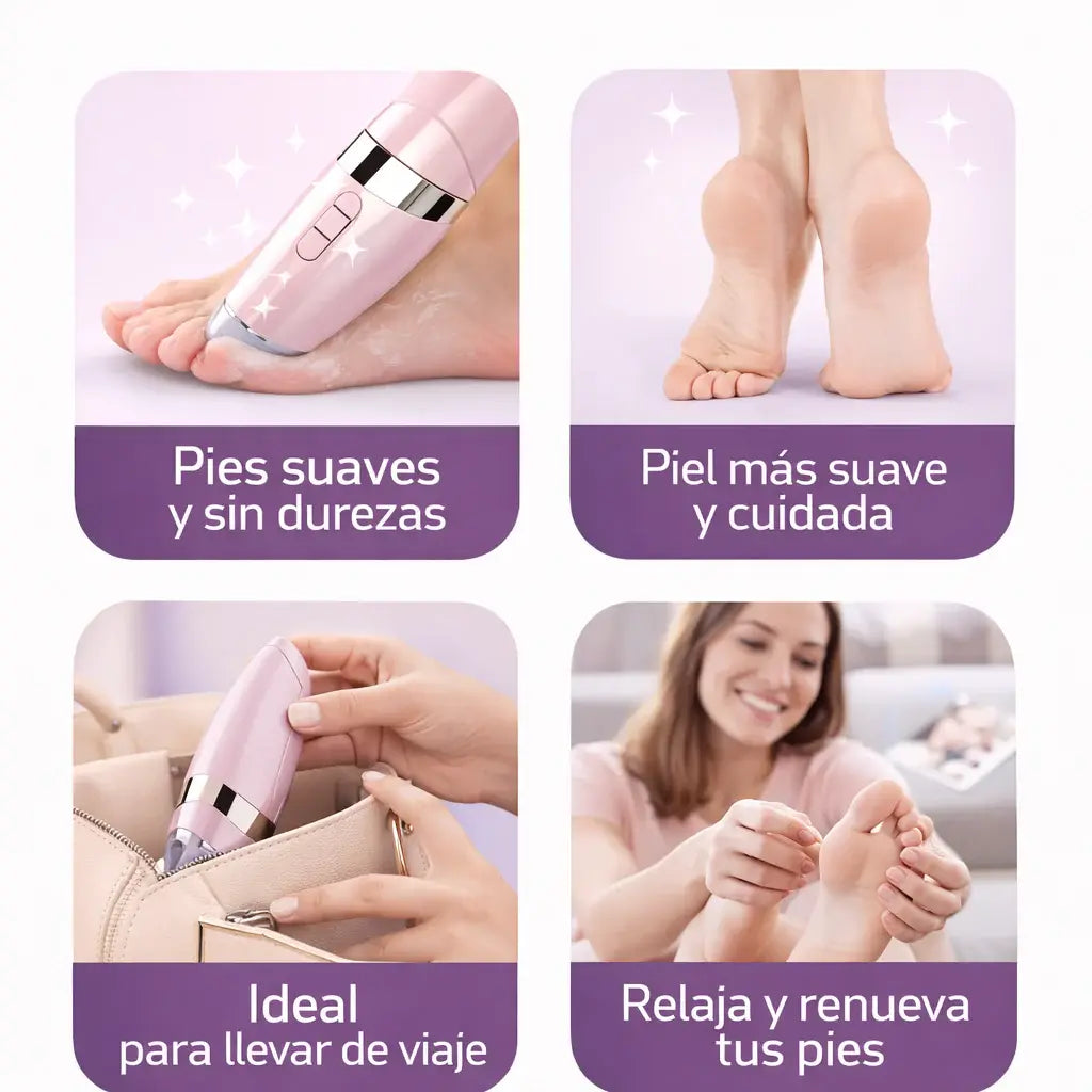 Elimina callos y recupera la suavidad de tus pies con Luve Pro