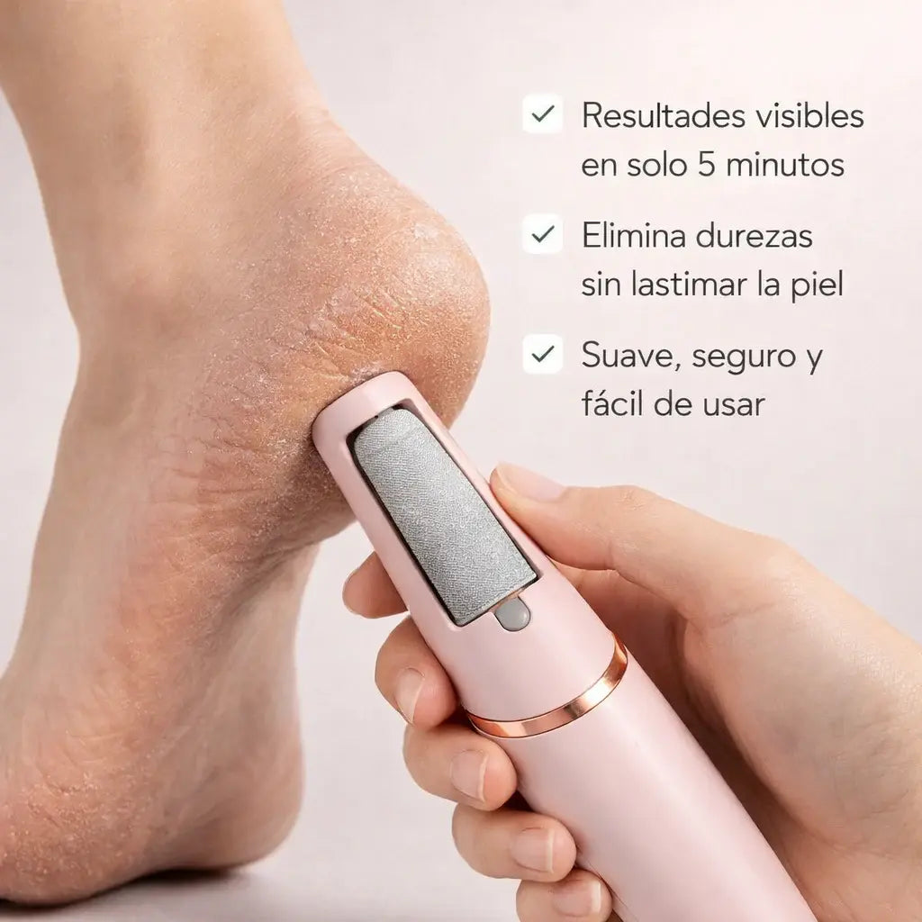 Elimina callos y recupera la suavidad de tus pies con Luve Pro